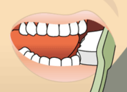 Toothbrush held at a 45-degree angle to the gumline