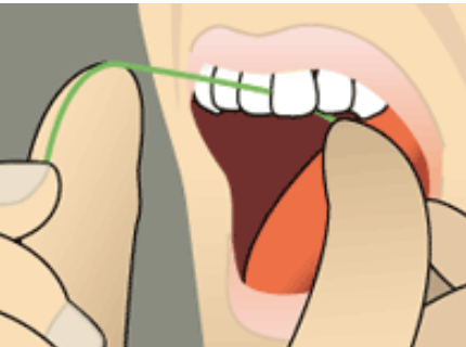 Curving the floss into a C-shape against a tooth beneath the gumline