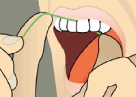 Moving the floss up and down against the side of the tooth