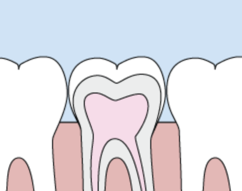 The sealed, protected tooth set in the gumline